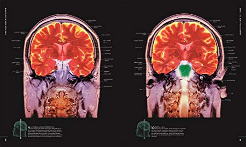 Das Gehirn: Anatomie, Sinneswahrnehmung, Gedächtnis, Bewusstsein, Störungen. Aktualisierte Neuausgabe - 8