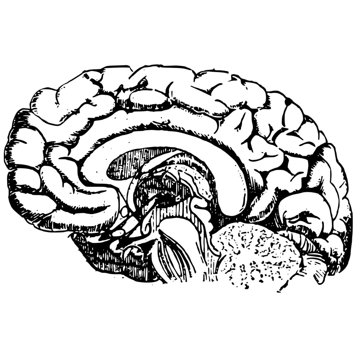 Der Unterschied zwischen Alzheimer und Demenz