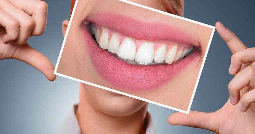 Auge Für Auge Zahn Für Zahn Was bedeutet Auge um Auge, Zahn um Zahn? Bedeutung, Herkunft und Verwendung