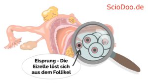 eisprung-eizelle-löst-sich-follikel (1)