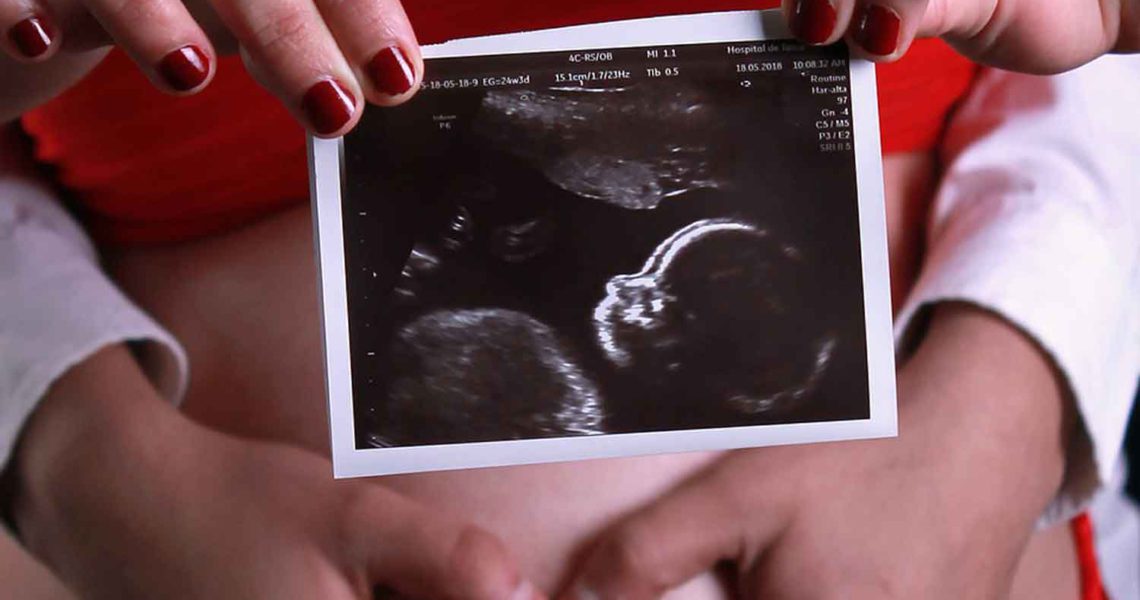 ultraschall untersuchungen in der schwangerschaft schädlich gefährlich.