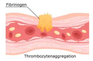 blutgerinnung Fibrinogen Thrombozytenaggregation